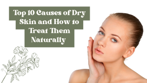 Read more about the article Top 10 Causes of Dry Skin and How to Treat Them Naturally